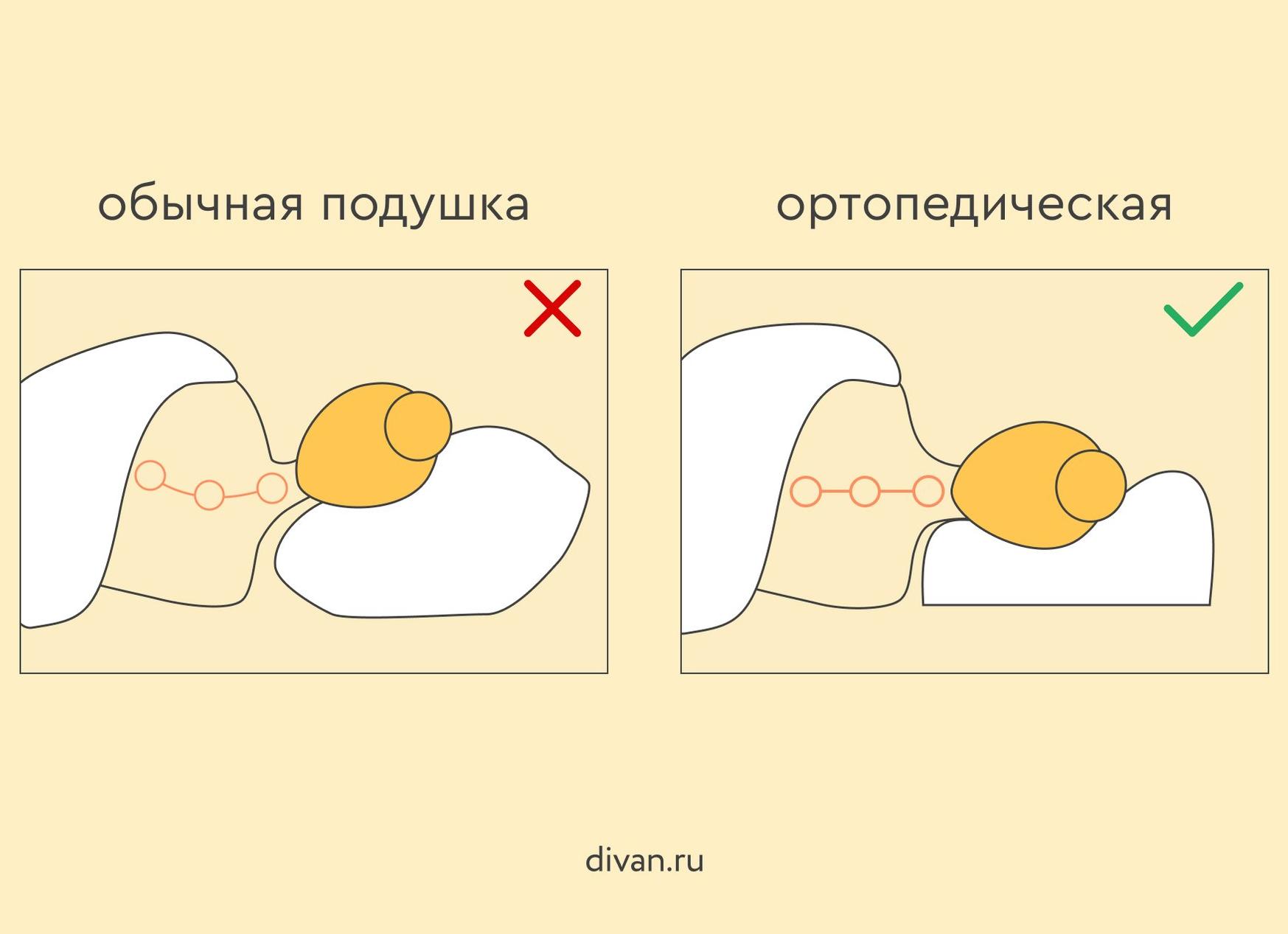 Как правильно выбрать ортопедическую подушку